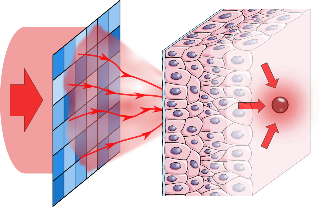 New publication in Photoniques, the SFO journal.